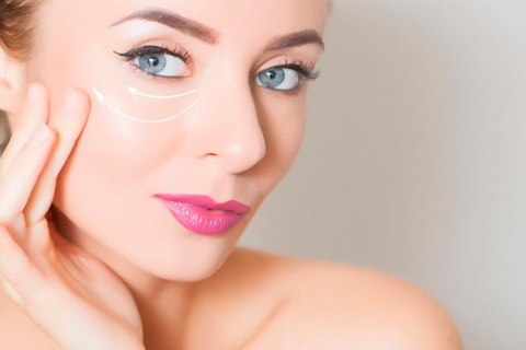 Blefaroplastia